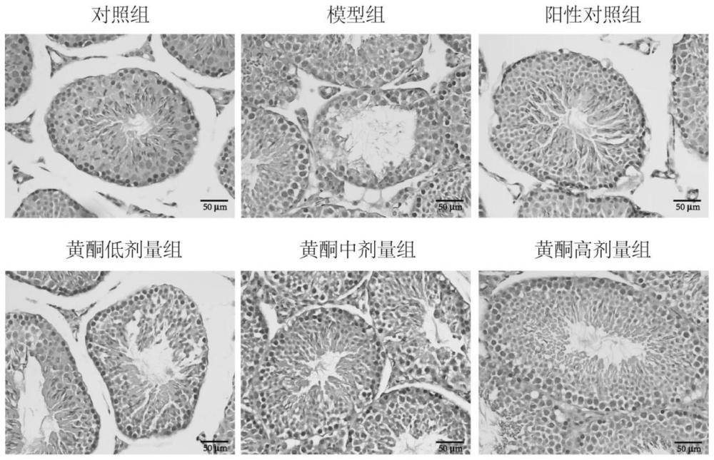 女貞子黃酮提取物在制備少弱精癥治療藥物中的應(yīng)用